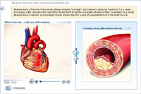 Atherosclerosis and coronary heart disease