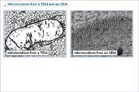 Mitochondrium from a TEM and an SEM
