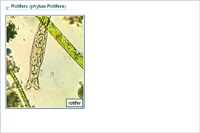 Rotifers (phylum Rotifera)