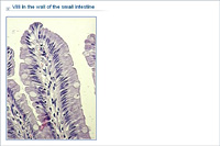 Villi in the wall of the small intestine