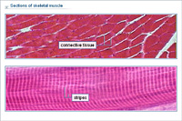 Sections of skeletal muscle