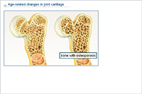 Age-related changes in joint cartilage
