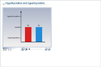 Hypothyroidism and hyperthyroidism