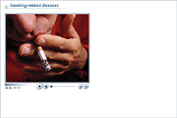 Smoking-related diseases
