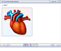Coronary heart disease