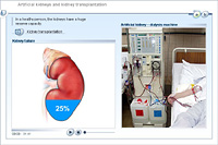 Artificial kidneys and kidney transplantation