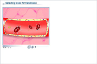 Selecting blood for transfusion