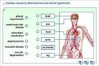 Diseases caused by atherosclerosis and arterial hypertension