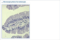 Microscopic photo of an enterocyte