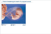 Factors threatening the health of a pregnant woman