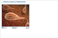 Infections caused by Giardia lamblia