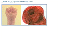 Heads of a pig tapeworm and a beef tapeworm