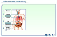 Diseases caused by tobacco-smoking