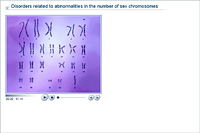 Disorders related to abnormalities in the number of sex chromosomes